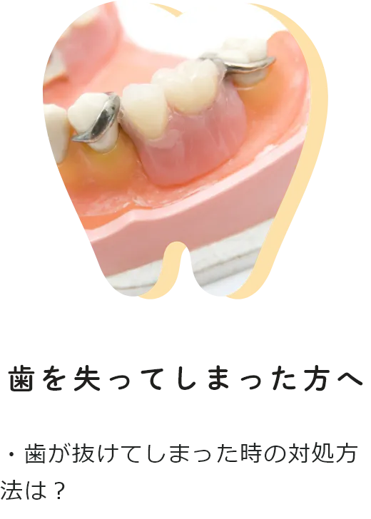 歯を失ってしまった方へ